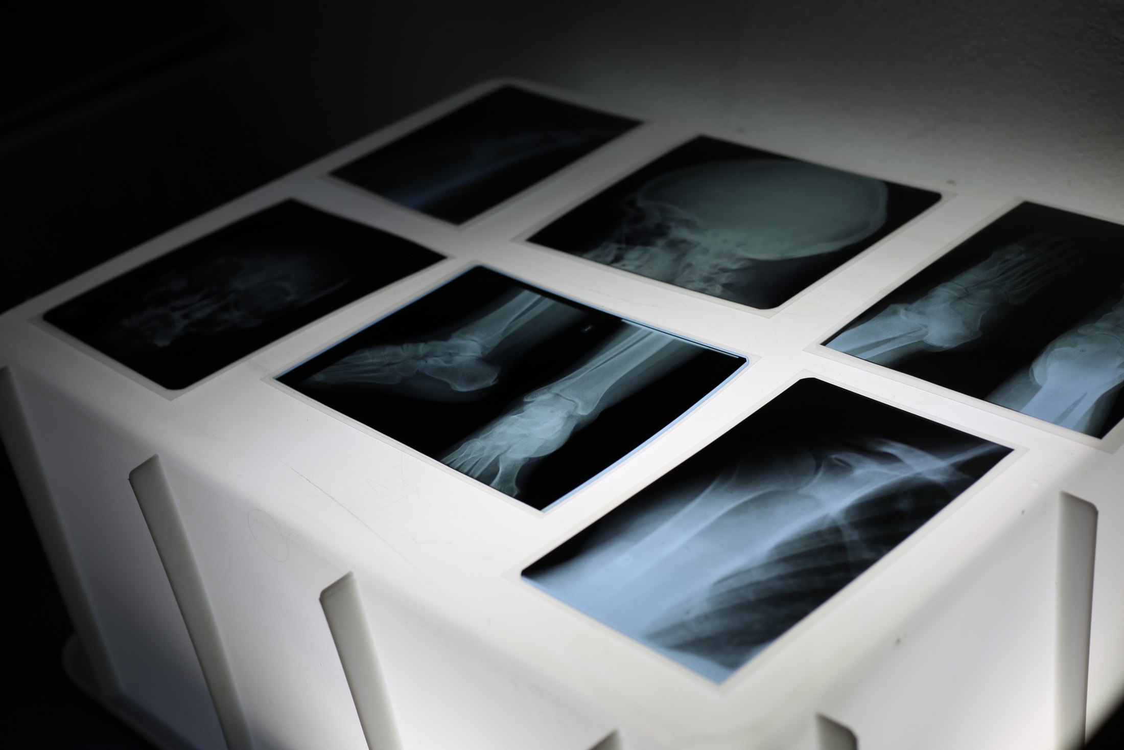Descubre H₂O · 02 · Agua, luz y transparencia · imagen 15.